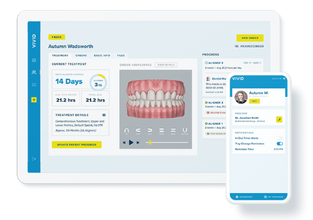 How it Works Vivid Aligners